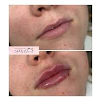 Image 42 of Aesthetics by Beauty Essentials Ltd