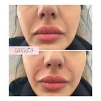 Image 56 of Aesthetics by Beauty Essentials Ltd