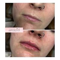 Image 58 of Aesthetics by Beauty Essentials Ltd