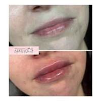 Image 57 of Aesthetics by Beauty Essentials Ltd