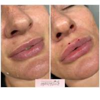 Image 44 of Aesthetics by Beauty Essentials Ltd