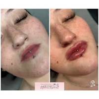 Image 45 of Aesthetics by Beauty Essentials Ltd