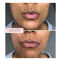 Image 48 of Aesthetics by Beauty Essentials Ltd