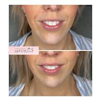 Image 50 of Aesthetics by Beauty Essentials Ltd