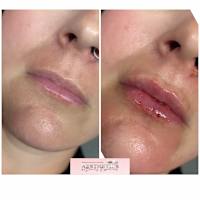 Image 41 of Aesthetics by Beauty Essentials Ltd