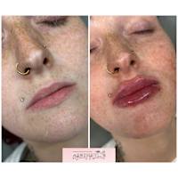 Image 51 of Aesthetics by Beauty Essentials Ltd