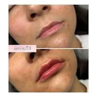 Image 55 of Aesthetics by Beauty Essentials Ltd