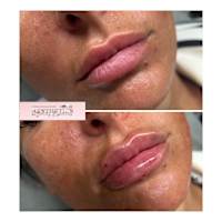 Image 52 of Aesthetics by Beauty Essentials Ltd