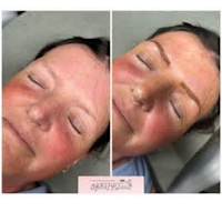 Image 46 of Aesthetics by Beauty Essentials Ltd