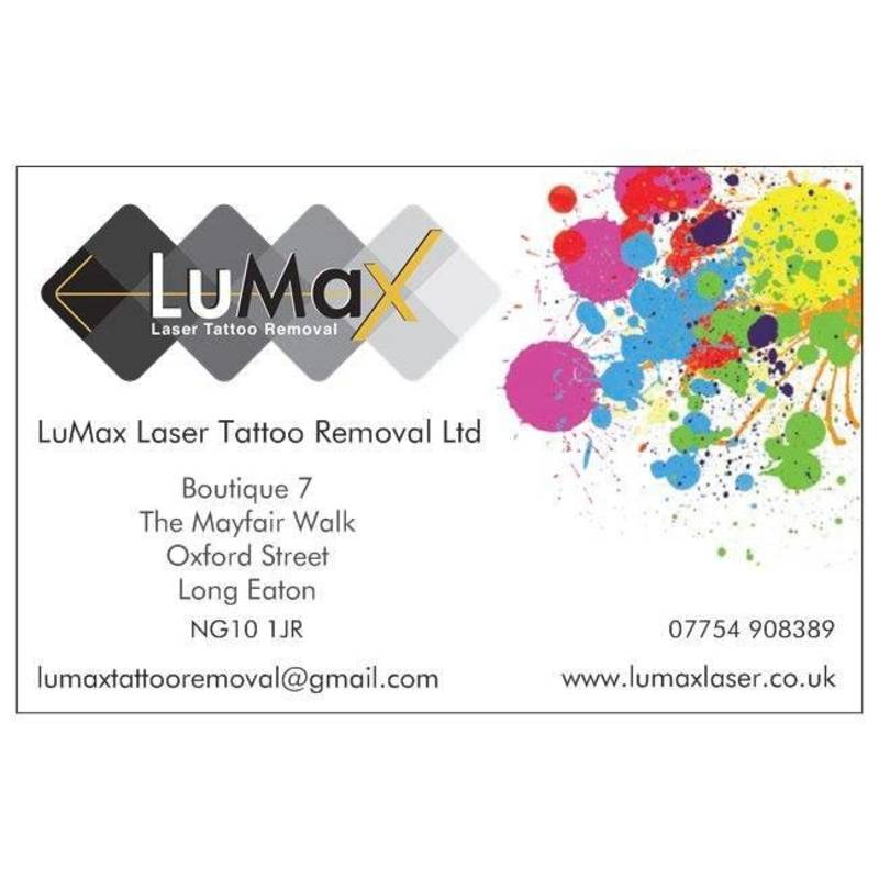 lumax laser tattoo removal ltd nottingham tattoo removal 4 lumax laser tattoo removal ltd nottingham tattoo removal 4