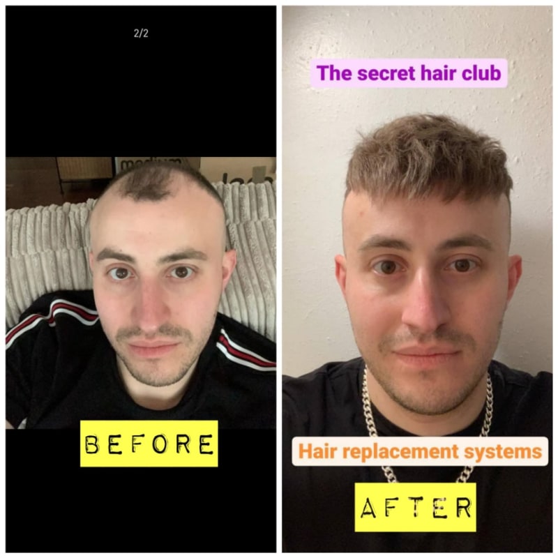The Secret Hair Club, Manchester | Hair Consultants - Yell