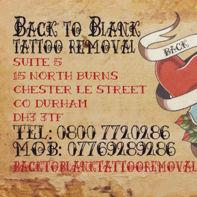 Razalight Welcome To Razalight Laser Tattoo Removal